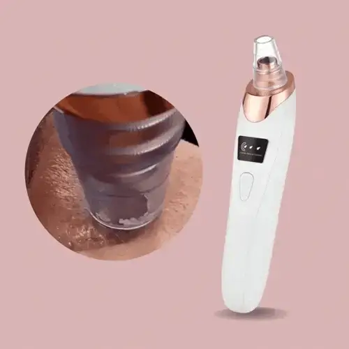 Blackhead Remover Vacuum | Deep Pore Cleanser | Adjustable Suction | Rechargeable | PureLure - Image 3