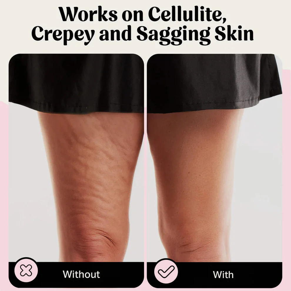 Body Skin Tape | Instant Lift & Firming | Invisible Hold | Sweatproof Support | Élevare - Image 7