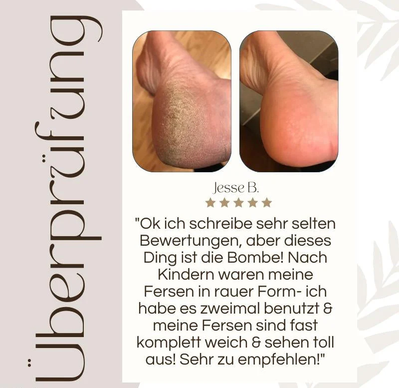 CallusPro™ - Electric Callus Remover - Image 9