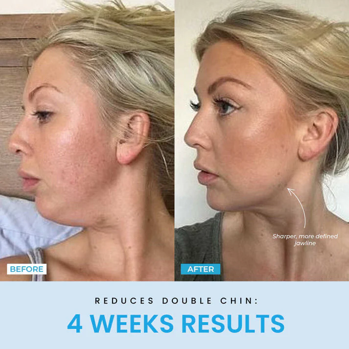 ContourVive™ – Tighten and Define Your Jawline for Timeless Confidence - Image 3