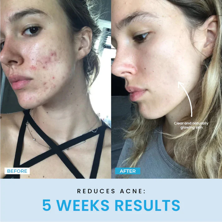 ContourVive™ – Tighten and Define Your Jawline for Timeless Confidence - Image 4