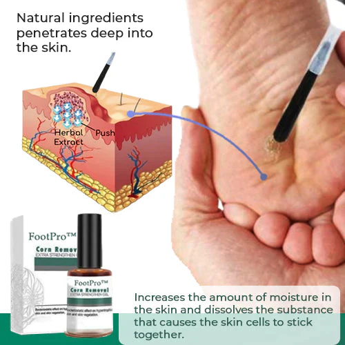 Corn Removal Gel | Extra Strength Formula | Precision Applicator | FootPro - Image 3