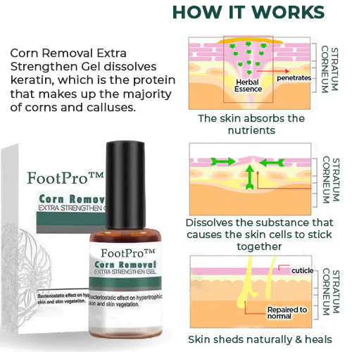 Corn Removal Gel | Extra Strength Formula | Precision Applicator | FootPro - Image 4