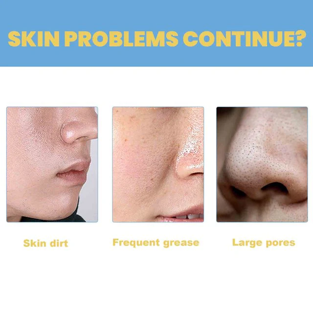 5+5 Free | DeepPurify™ Clarifying Serum — Dissolves Blackheads for Smooth, Radiant Skin - Image 3