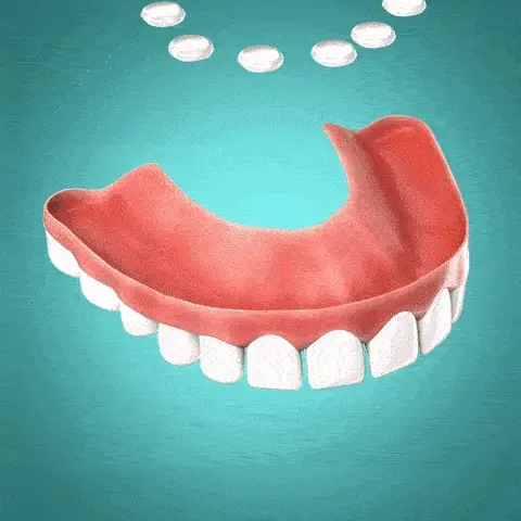 Dental Prosthesis Silicone Set | Custom-Fit Denture Liner | Soft & Non-Toxic Comfort Gel - Image 6