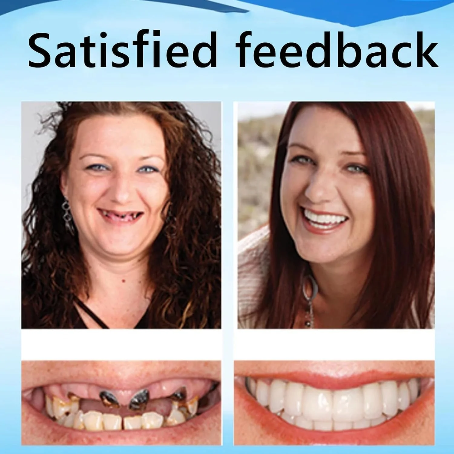 Denture Reline Kit | Silicone Denture Reline | Denture Repair Kit| RenewSmile - Image 3