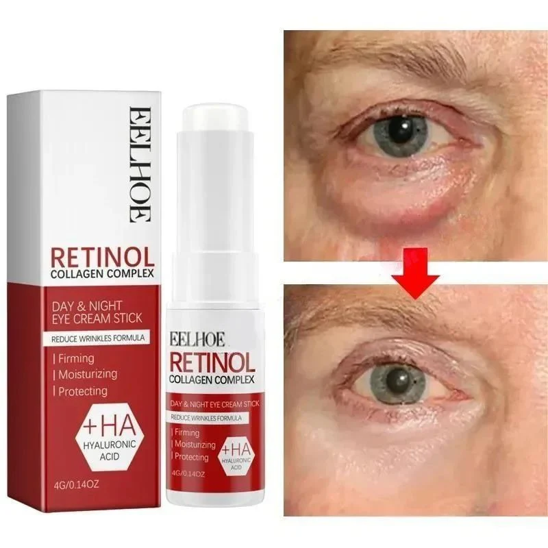 Eye Bag Remove Cream | Puffiness And Dark Circle Care | Smooth Under Eye Finish | EyeRenew