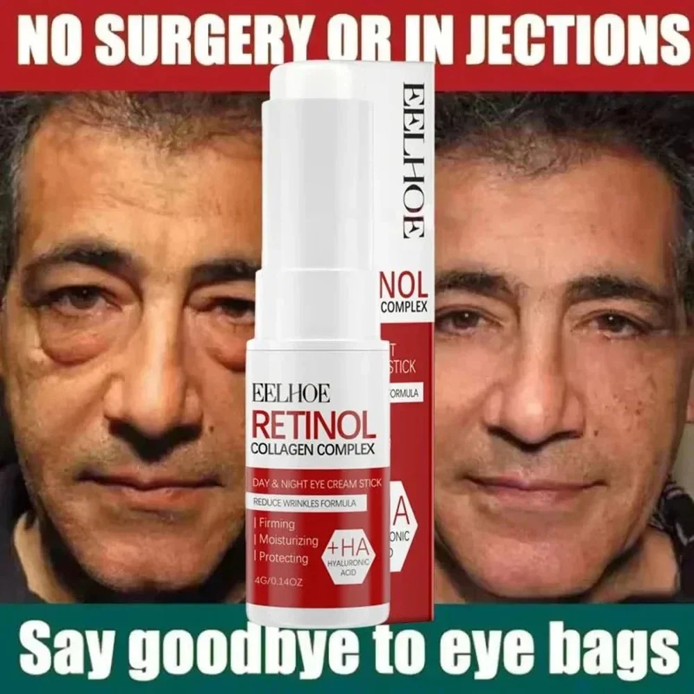 Eye Bag Remove Cream | Puffiness And Dark Circle Care | Smooth Under Eye Finish | EyeRenew - Image 6