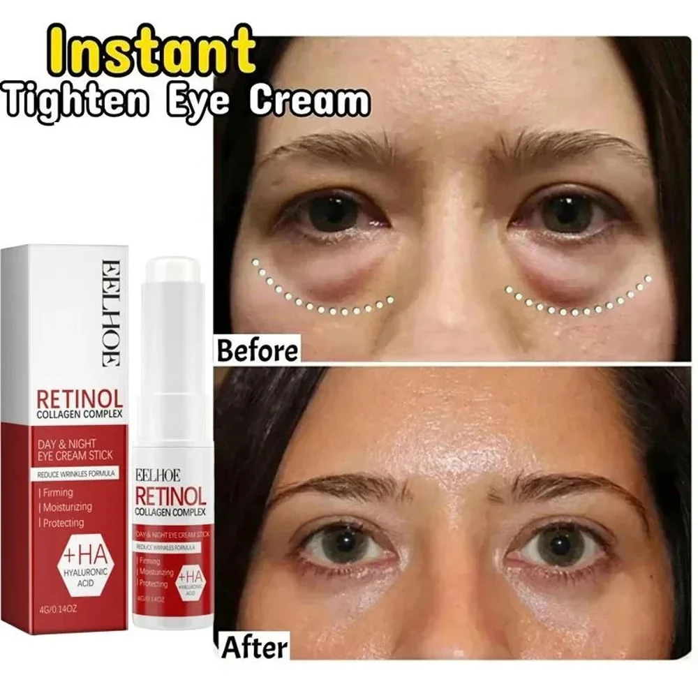 Eye Bag Remove Cream | Puffiness And Dark Circle Care | Smooth Under Eye Finish | EyeRenew - Image 9