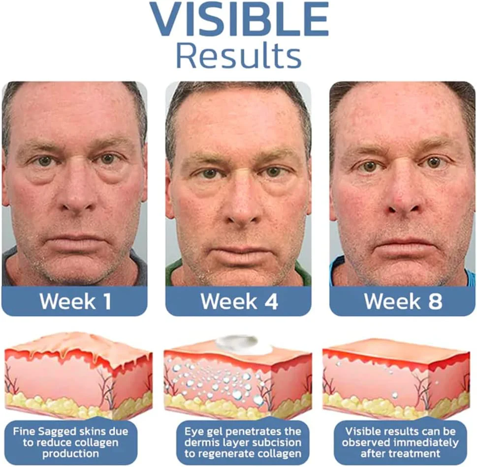 Eye Lifting Gel | Peptide Formula | Reduces Puffiness | Firming Effect | LumiLift - Image 5