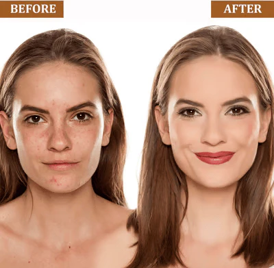 1+1 FREE | Foundation Stick™ — Perfect Skin That Adapts and Cares All Day - Image 3