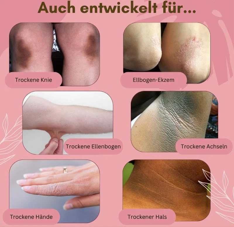 1+1 FREE | FungaRelief™ Arnica Cream — Heal, Nourish, and Protect Your Feet with One Cream - Image 4