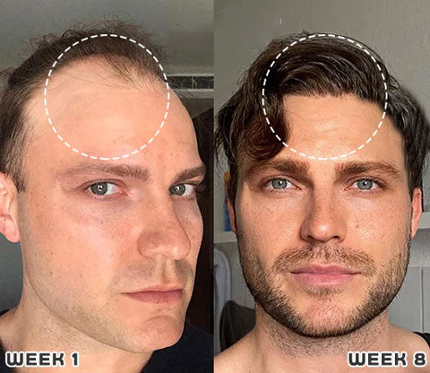 1+1 FREE | GlowMane™ Enjoy strong and healthy hair! - Image 3