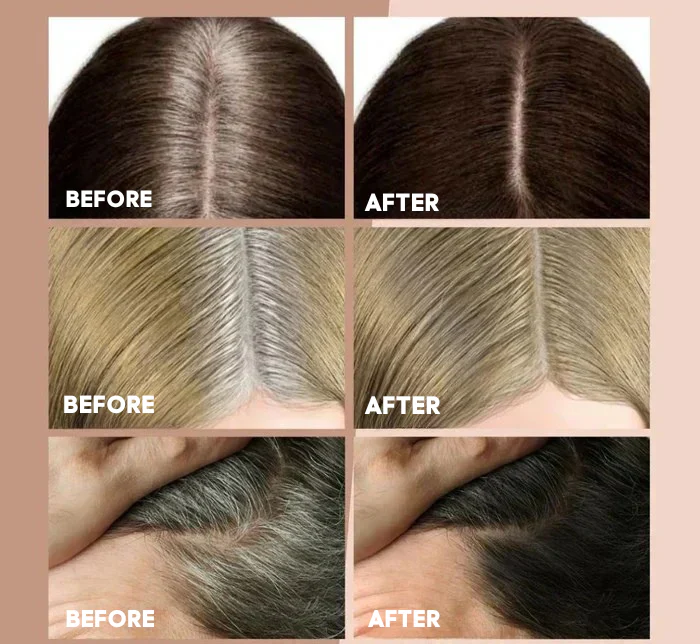 Hair Powder | Waterproof Coverage | Natural Hairline | Long-Lasting Finish | BeautyBlend - Image 4
