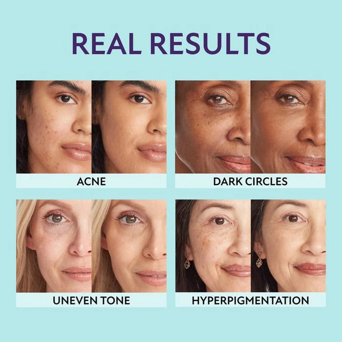 Hydrating Concealer | All-in-One Complexion Perfector | SupremeCrème - Image 5