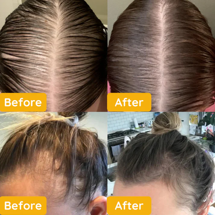 1+1 FREE | Jairy™ Wake Up to Naturally Thicker, Stronger Hair - Image 2