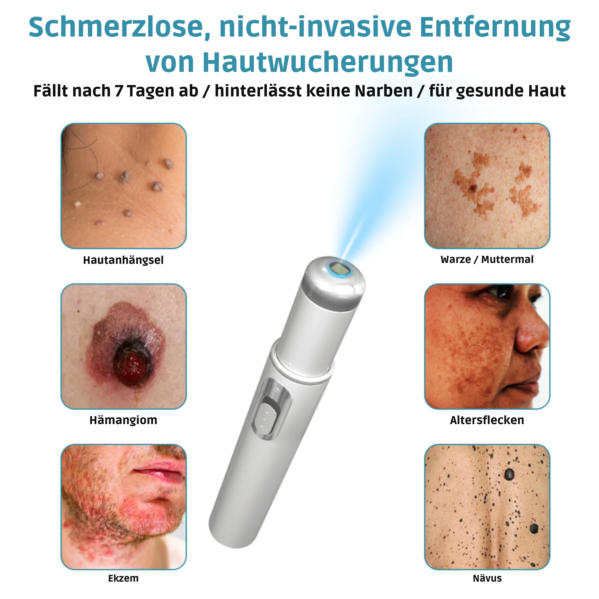 Klara™ Painless Laser Pen — Reveal Flawless Skin And Confidence Anytime - Image 2