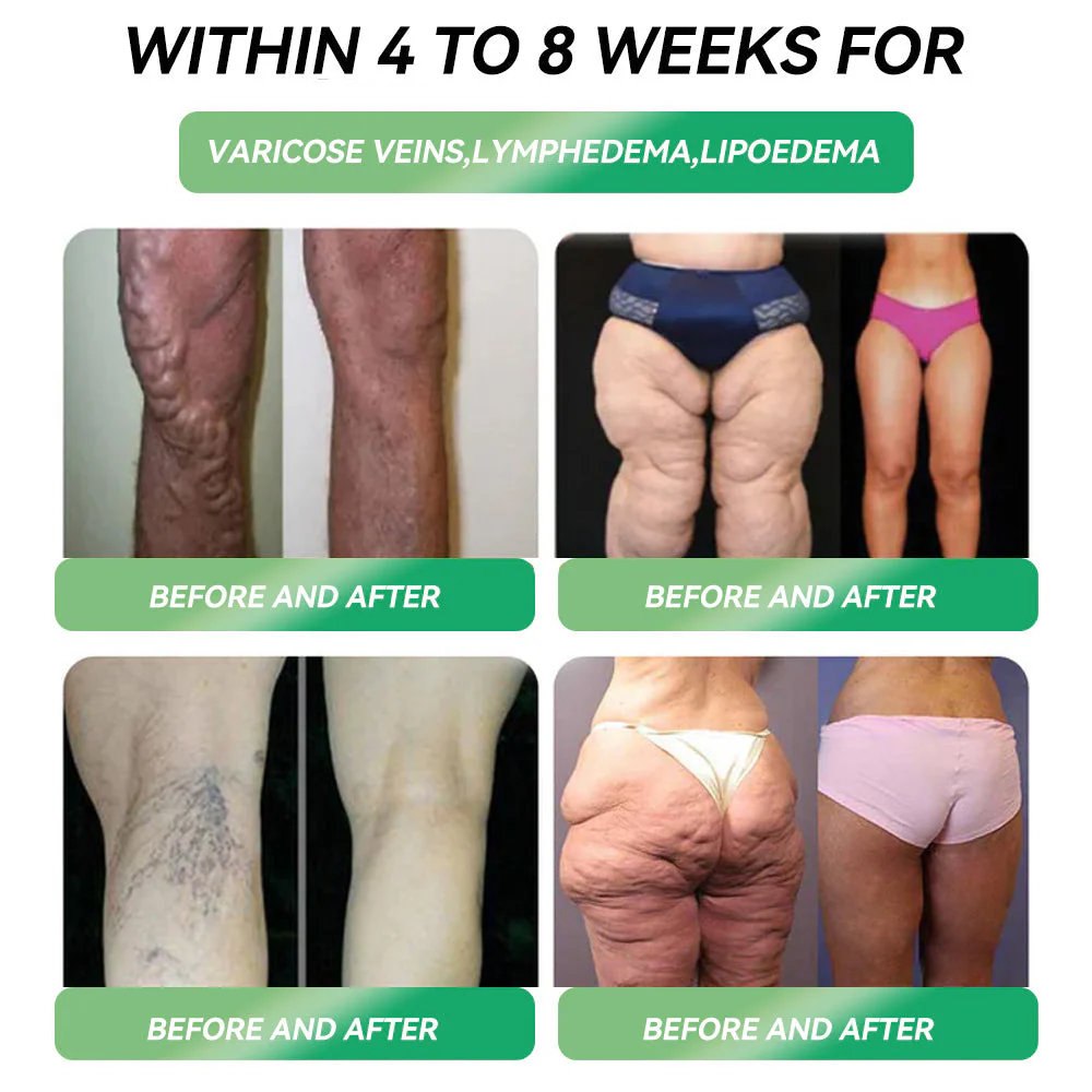 1+1 Free | LOVILDS™ SMGT-GLP-1 Nano-Microneedle Patch – Rapid Fat Loss with Painless All-Day Weight Control - Image 4