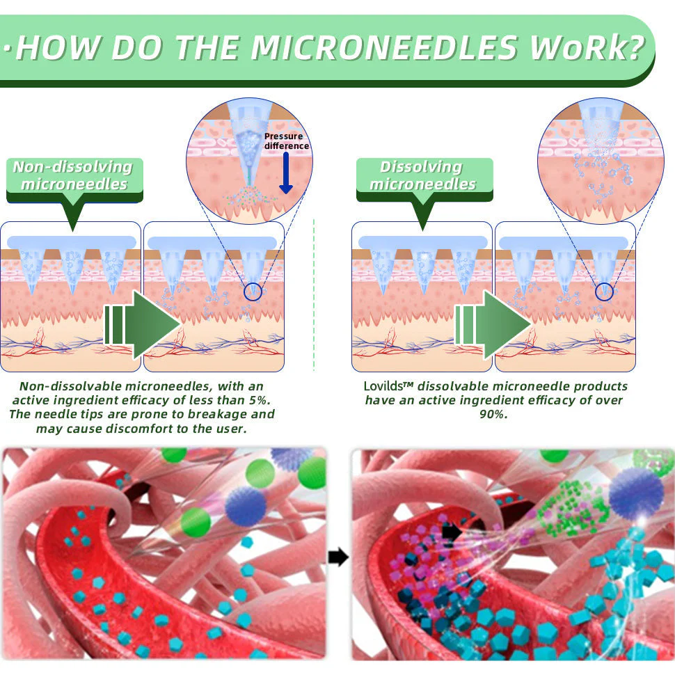 1+1 Free | LOVILDS™ SMGT-GLP-1 Nano-Microneedle Patch – Rapid Fat Loss with Painless All-Day Weight Control - Image 6