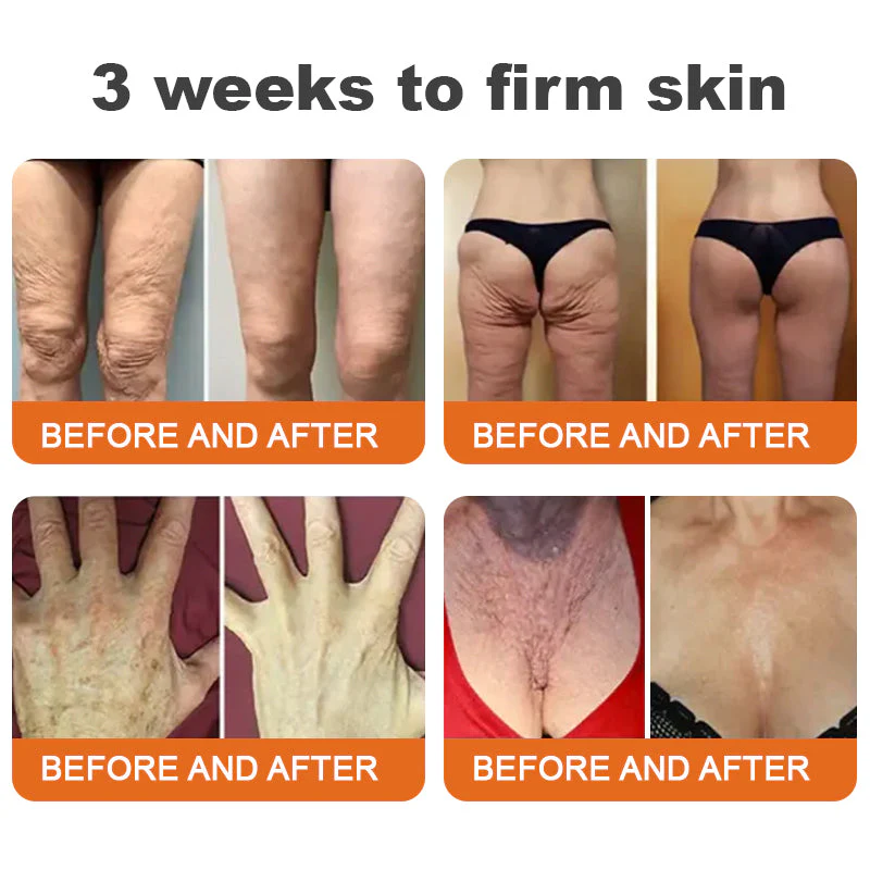 1+1 Free | LOVILDS™ Botulinum Toxin Honey Gift Tightening Serum Stick – Transform Your Skin in Just 7 Days with Firmness and Youthful Radiance - Image 3