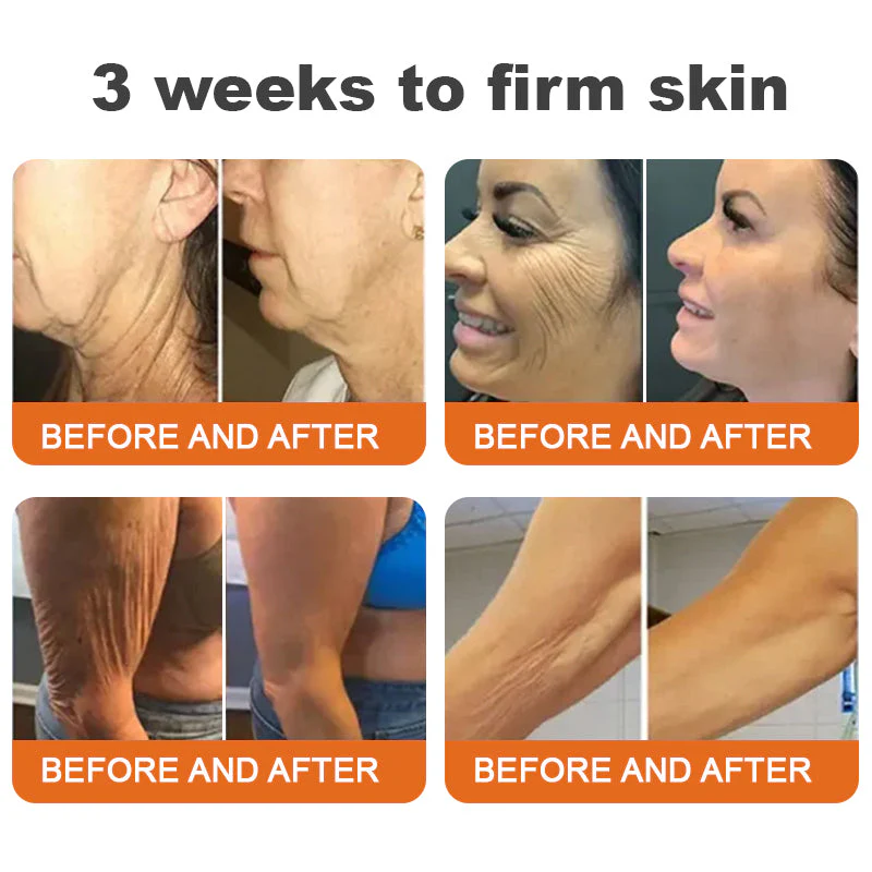 1+1 Free | LOVILDS™ Botulinum Toxin Honey Gift Tightening Serum Stick – Transform Your Skin in Just 7 Days with Firmness and Youthful Radiance - Image 4