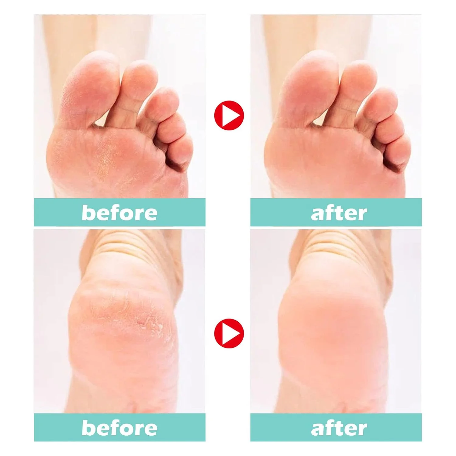 1+1 FREE | Medical Foot Care Cream™ — Heals and protects cracked skin for lasting comfort - Image 2