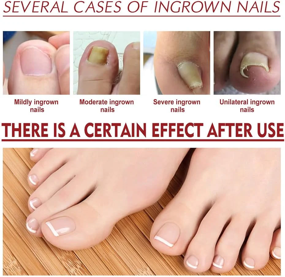 Nail Care Serum | Brittle Nail Repair | Visible Results in 4 Weeks | Easy Daily Use | HealNail - Image 3