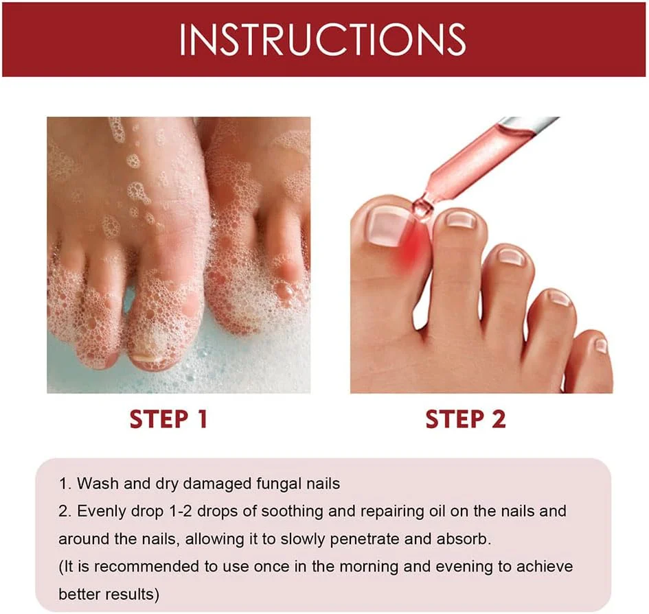 Nail Care Serum | Brittle Nail Repair | Visible Results in 4 Weeks | Easy Daily Use | HealNail - Image 4