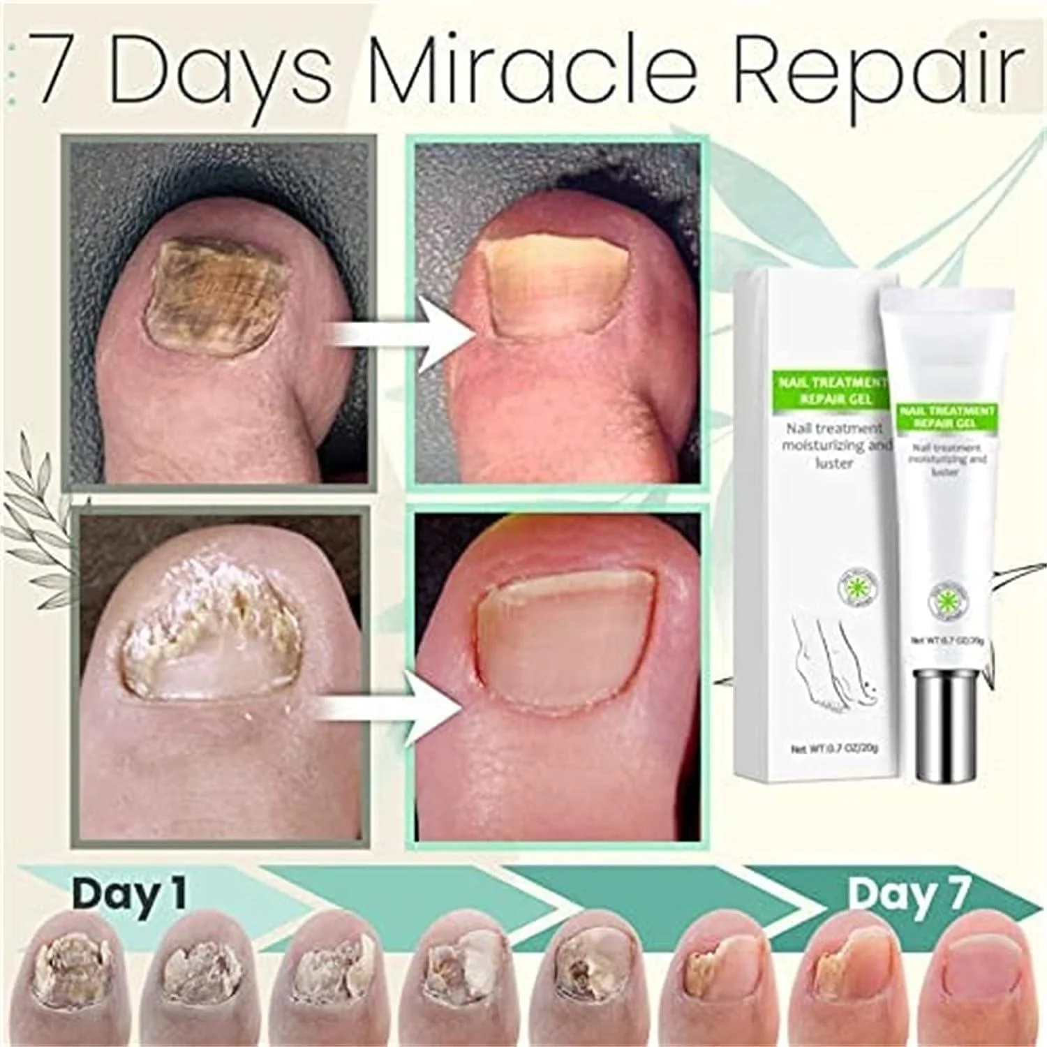Nail Repair Gel | Strengthens Damaged Nails | Hydrating Care Formula | RejuveNail - Image 3