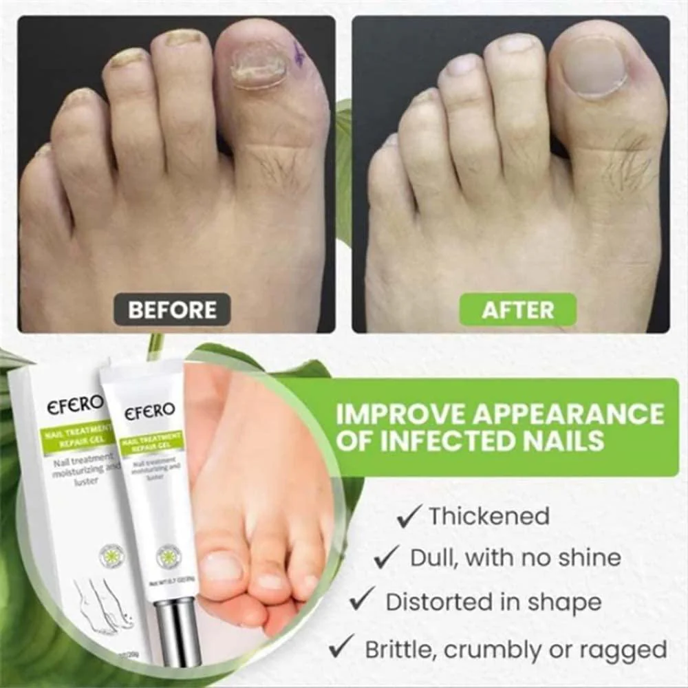 Nail Repair Gel | Strengthens Damaged Nails | Hydrating Care Formula | RejuveNail - Image 4