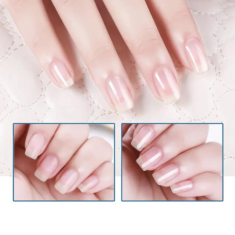 Nail Repair | Intensive strengthening treatment for brittle nails | NailRevive - Image 4