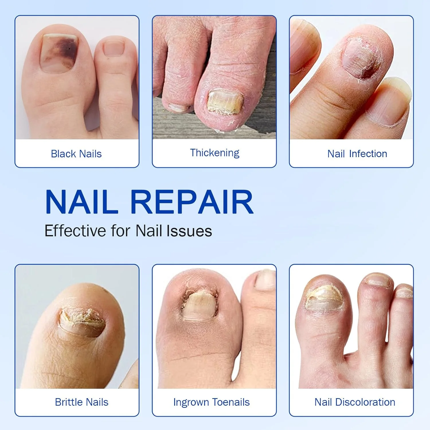 Nail Fungus Patches | Antifungal Nail Care | Overnight Repair | Nailox - Image 6