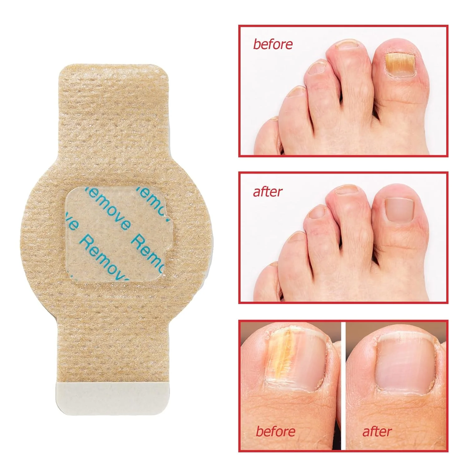 Nail Fungus Patches | Antifungal Nail Care | Overnight Repair | Nailox - Image 9