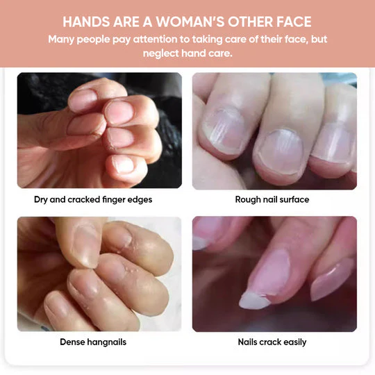 1+1 FREE | Nails Nutritious Growth Oil™ – Reveal stronger, healthier nails that shine with every touch - Image 3