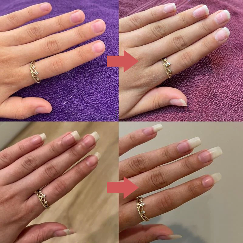 1+1 FREE | Nails Nutritious Growth Oil™ – Reveal stronger, healthier nails that shine with every touch - Image 9