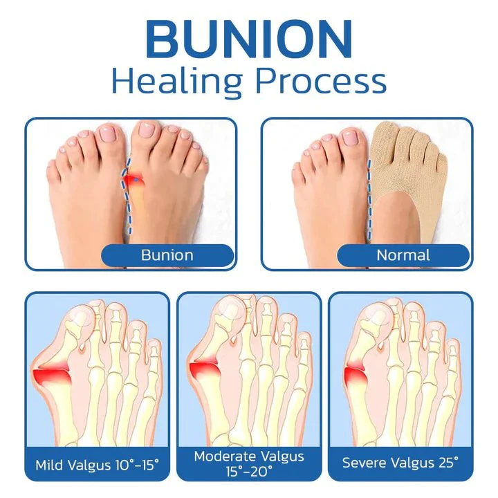 Orthopedic Support Socks | Bunion Relief Design | All-Day Comfort | SoothePlus - Image 3