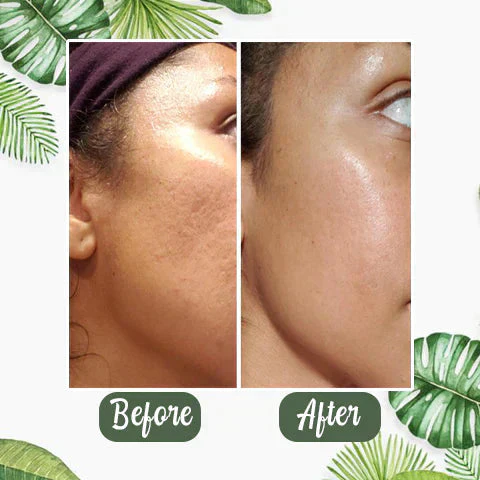 1+1 FREE | Poreless Deep Cleanse Mask Stick™ — Reveals fresh, radiant skin without blackheads and shine - Image 10