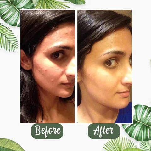 1+1 FREE | Poreless Deep Cleanse Mask Stick™ — Reveals fresh, radiant skin without blackheads and shine - Image 12