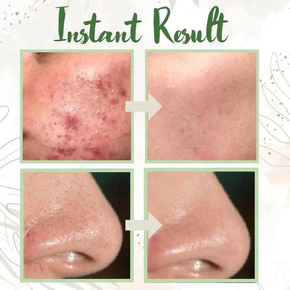 1+1 FREE | Poreless Deep Cleanse Mask Stick™ — Reveals fresh, radiant skin without blackheads and shine - Image 13