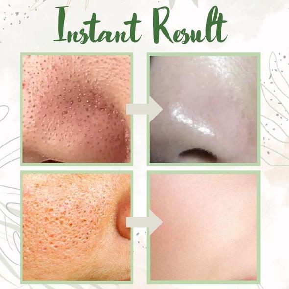 1+1 FREE | Poreless Deep Cleanse Mask Stick™ — Reveals fresh, radiant skin without blackheads and shine - Image 14