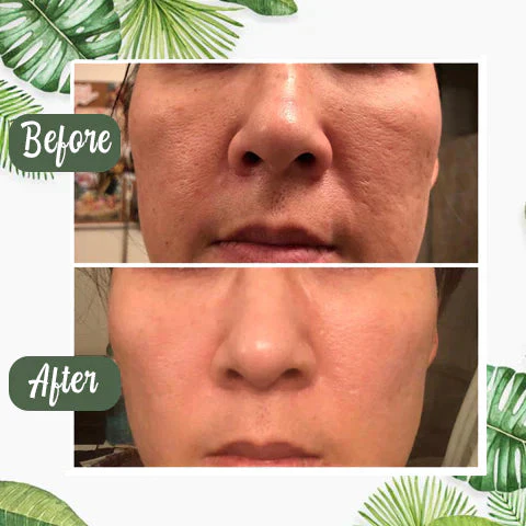 1+1 FREE | Poreless Deep Cleanse Mask Stick™ — Reveals fresh, radiant skin without blackheads and shine - Image 8