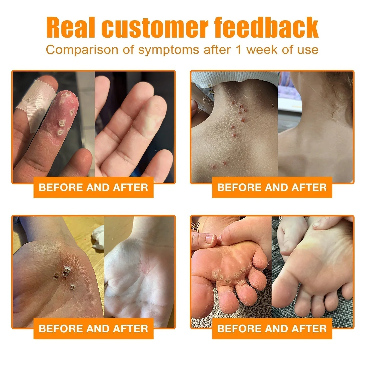Skin Tag Remover | Bee Venom Formula | Painless Use | NewYou - Image 4