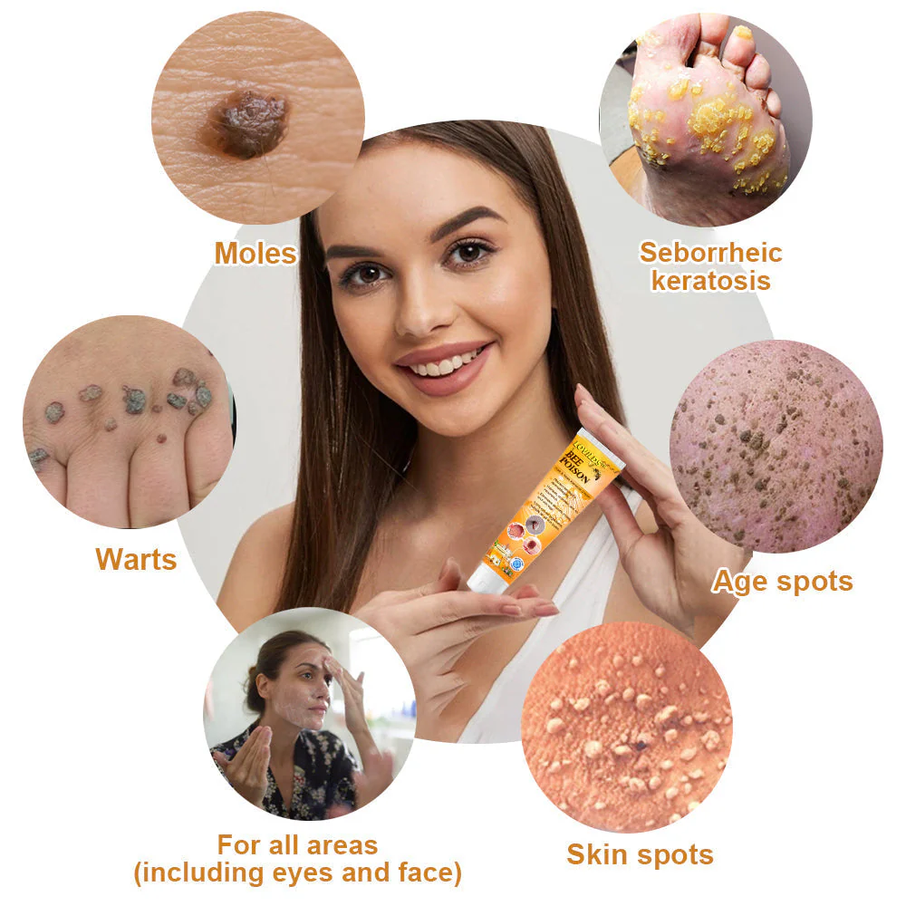 Skin Tag Remover | Bee Venom Formula | Painless Use | NewYou - Image 9