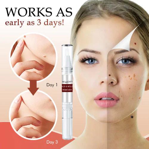 Skin Tag Remover | Fast-Acting Formula | Painless Application - Image 3