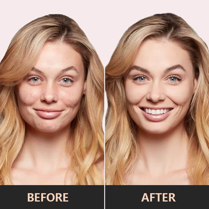 SkinBlend™ – Youthful Radiance - Image 3
