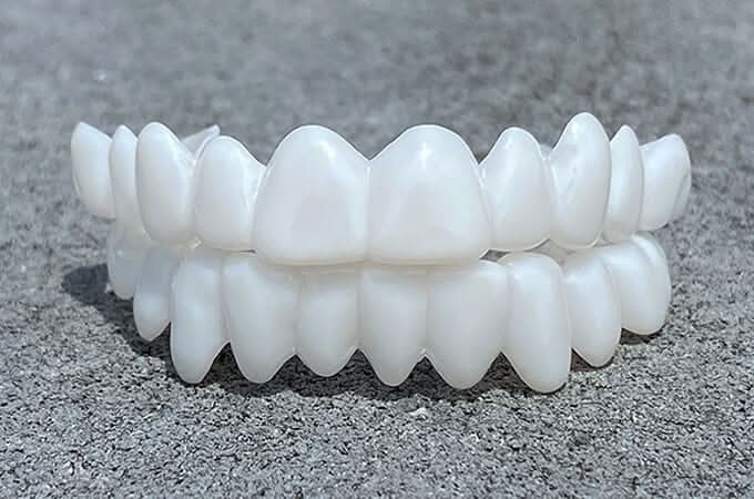 Snap On Veneers | Removable Teeth Veneers | Instant Smile Teeth Cover | SmileFlex - Image 2