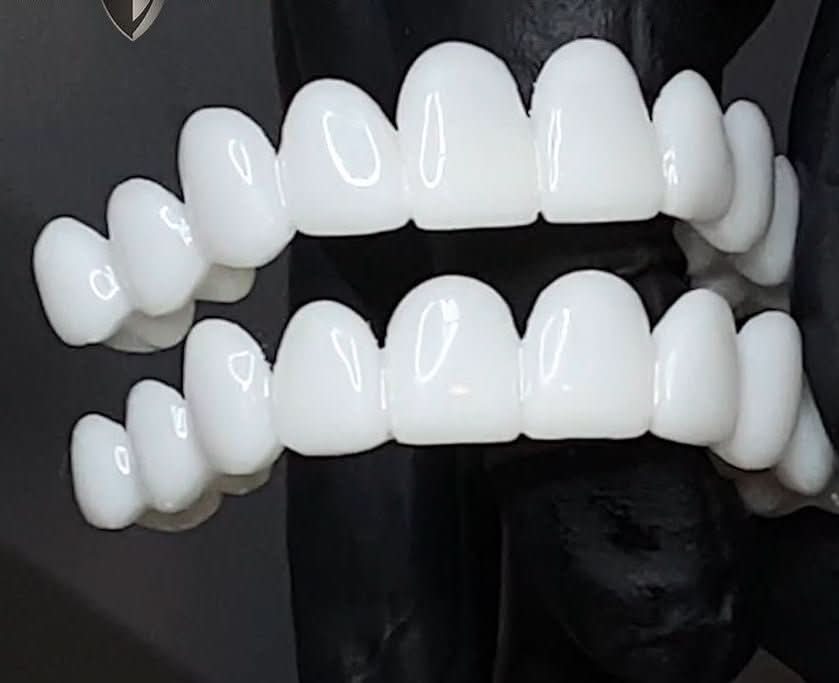 Snap On Veneers | Removable Teeth Veneers | Instant Smile Teeth Cover | SmileFlex - Image 5