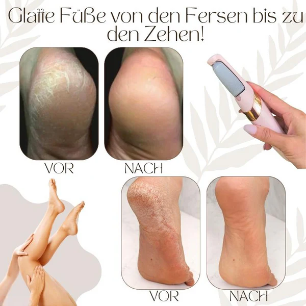 VelvetStep™ — Discover Baby-Soft Feet You'll Be Proud to Show Off - Image 2