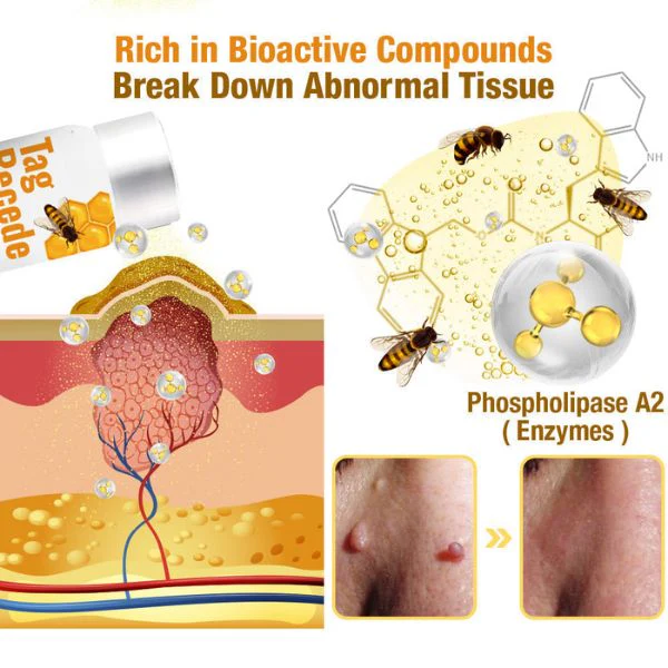 Wart Removal Spray | Bee Venom Formula | Gentle Skin Repair - Image 3