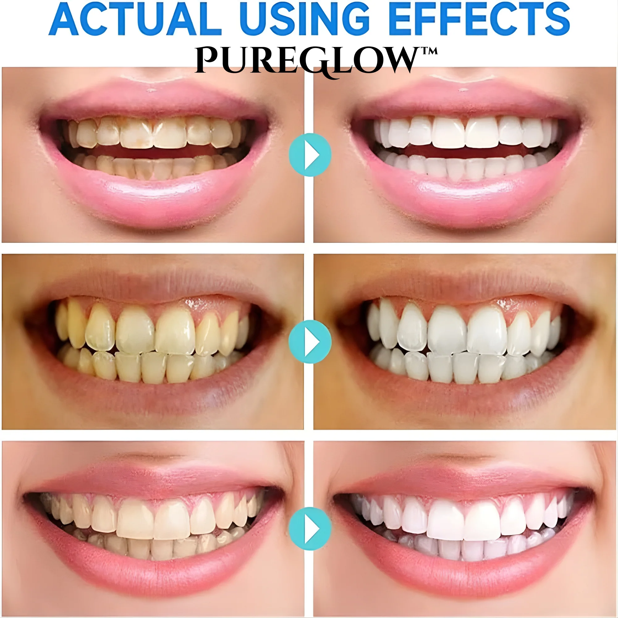 Whitening Toothpaste | Niacinamide Formula | Enamel Repair | Fresh Breath | PureGlow - Image 5